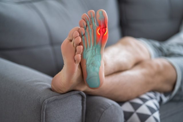 Comment soulager l'hallux valgus avec des remèdes de grand-mère ?