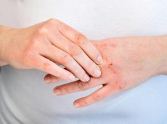 Pourquoi ma paume de main me gratte-t-elle : signes et significations cachés ? Pourquoi ma paume de main me gratte-t-elle : signes et significations cachés ?