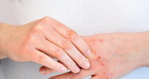 Pourquoi ma paume de main me gratte-t-elle : signes et significations cachés ? Pourquoi ma paume de main me gratte-t-elle : signes et significations cachés ?