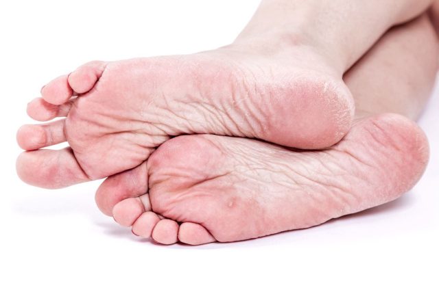 Comment soigner efficacement les pieds très secs avec des remèdes de grand-mère ?