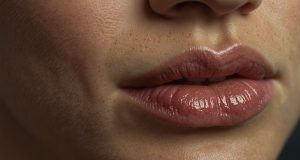 Comment identifier et traiter efficacement les grains de Fordyce sur les lèvres ? Comment identifier et traiter efficacement les grains de Fordyce sur les lèvres ?