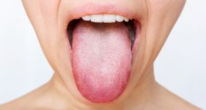 Langue blanche : est-ce un signe de problème au foie ou à l’estomac ? Langue blanche : est-ce un signe de problème au foie ou à l'estomac ?